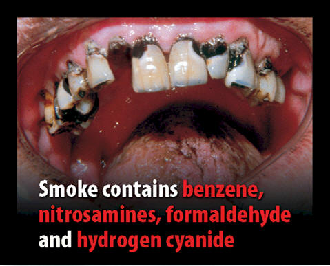 Guernsey 2011 Consituents - diseased organ, benzene, nitrosamines, formaldehyde, hydrogen cyanide